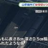 JR山手線・大崎駅で女性切り付け事件…傷デカすぎる…（画像あり）