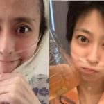 【閲覧注意】小林麻央さん、皮膚からガンが飛び出していた・・・
