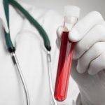 【閲覧注意】糖尿病患者の現実がこちら…人生終わりやわ…