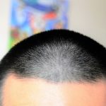 【新型コロナ】医師や看護師、数百人が丸刈りに…その理由(画像あり)