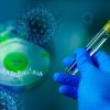 【新型コロナ】厚労省、PCR検査の新たな「相談目安」を発表！！！