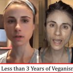 【衝撃画像】ヴィーガンになった美女、たった3年で変わり果てた姿で発見される