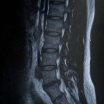【超戦慄】日本人の死因の第一位が『これ』らしいぞ・・・・